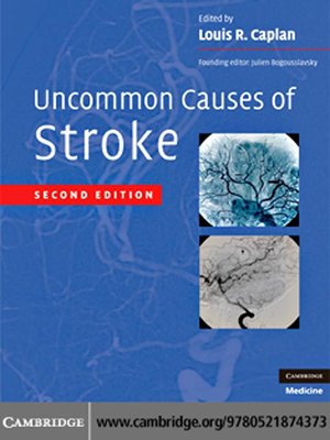 cover image of Uncommon Causes of Stroke
